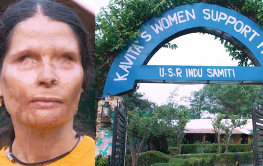 acid attack victim kavita bisht